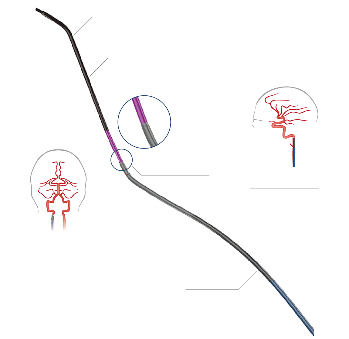 通路产品| Genesis MedTech